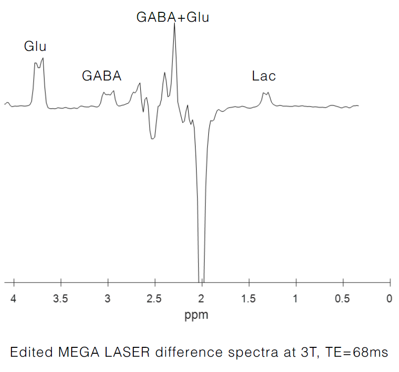 Edited MEGA LASER difference spectra at 3T, TE=68ms