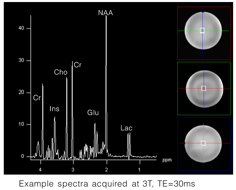 Example spectra acquired at 3T, TE=30ms
